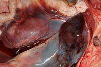 Bleeding in Kidney & muscles